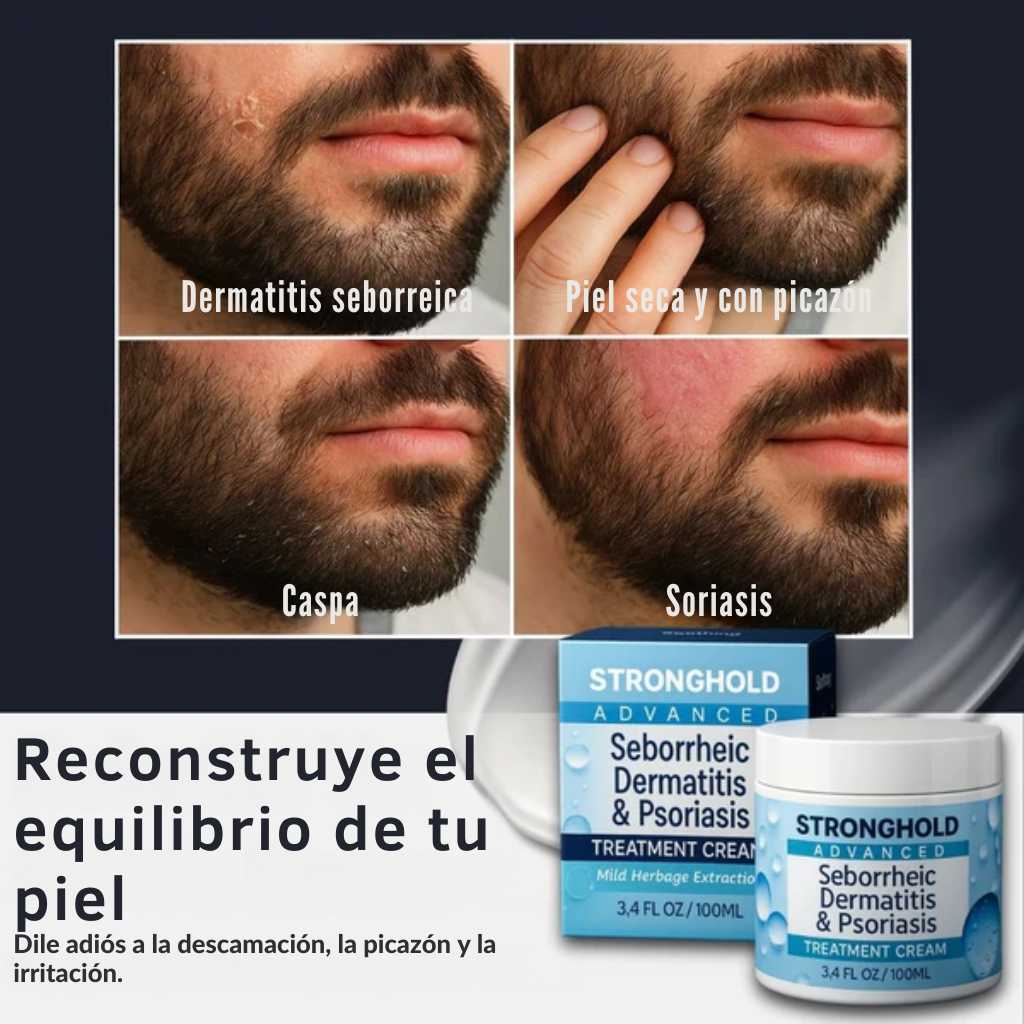 Advanced Seborrheic Dermatitis & Psoriasis Crema